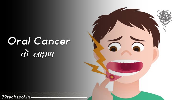 Oral Cancer Ke Lakshan: लक्षण, रिस्क, निदान, स्टेज, उपचार (2022)
